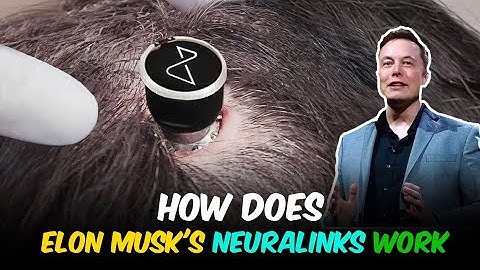Unlocking Neuralink | How Elon Musk