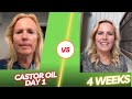 Over 50? I Used Castor Oil on My Face for 30 Days-The Results Are Shocking!