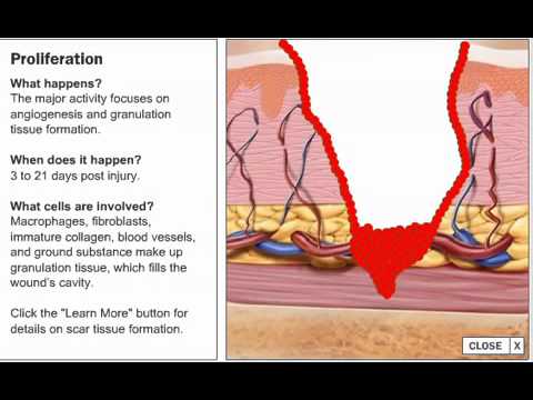 Wound Healing Process