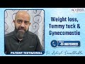 Gynecomastia Surgery Patient Feedback | Medispa Reviews | Best Plastic Surgeon in Pune | Dr. Ashish