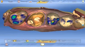 4 4 Chairside CEREC Software Overview