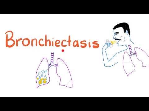 Videó: Bronchiectasis: Kialakulóban Lévő Globális Járvány