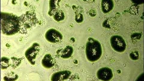 Making microcapsules