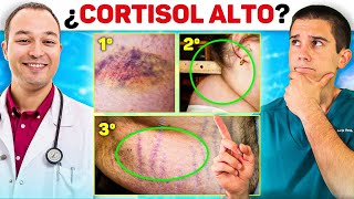 ASÍ afecta el CORTISOL ALTO a tu SALUD y PÉRDIDA DE GRASA: Con Antonio Mas ENDOCRINO