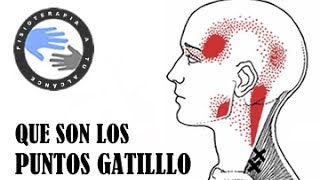 Puntos de detrás cabeza la sensibles fibromialgia