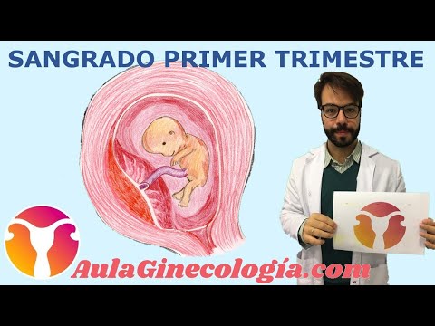 Video: ¿Alguien ha sangrado al principio del embarazo?