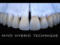 Miyo hybrid technique  workflow with miyo and insync zr veneering ceramic  asmr