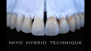 MiYO Hybrid Technique - Workflow with MiYO and InSync ZR veneering ceramic  [ASMR]