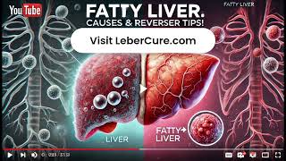 The Truth About Fatty Liver: Causes, Symptoms, and How to Reverse It #liverdamage #fattyliver