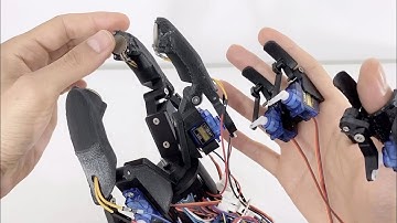 Youbionic Feedback