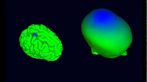 Simulated Alpha Band EEG