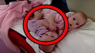 Formerly Conjoined Twins Finally Share Their Journey 18 Years After Separation