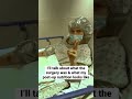 I recently had InterStim surgery #shorts #interstim #bladderproblems #interstitialcystitis