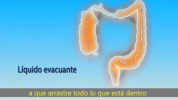 ¿Cuánto tiempo se tarda en limpiar los intestinos para una colonoscopia?