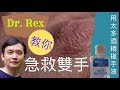 [急救雙手]常用搓手液現後遺症,Dr.Rex教你用這2招急救及保護雙手Doctor teaches you ways to manage dry cracked hands(中文/EngSub)