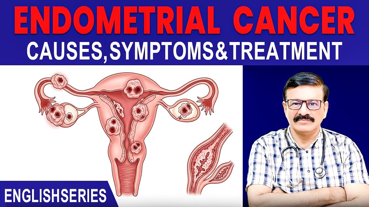 Explain Gynecological & Endometrial Cancers Causes, Symptoms & Treatment  l Dr. Anwar Shahzad  l