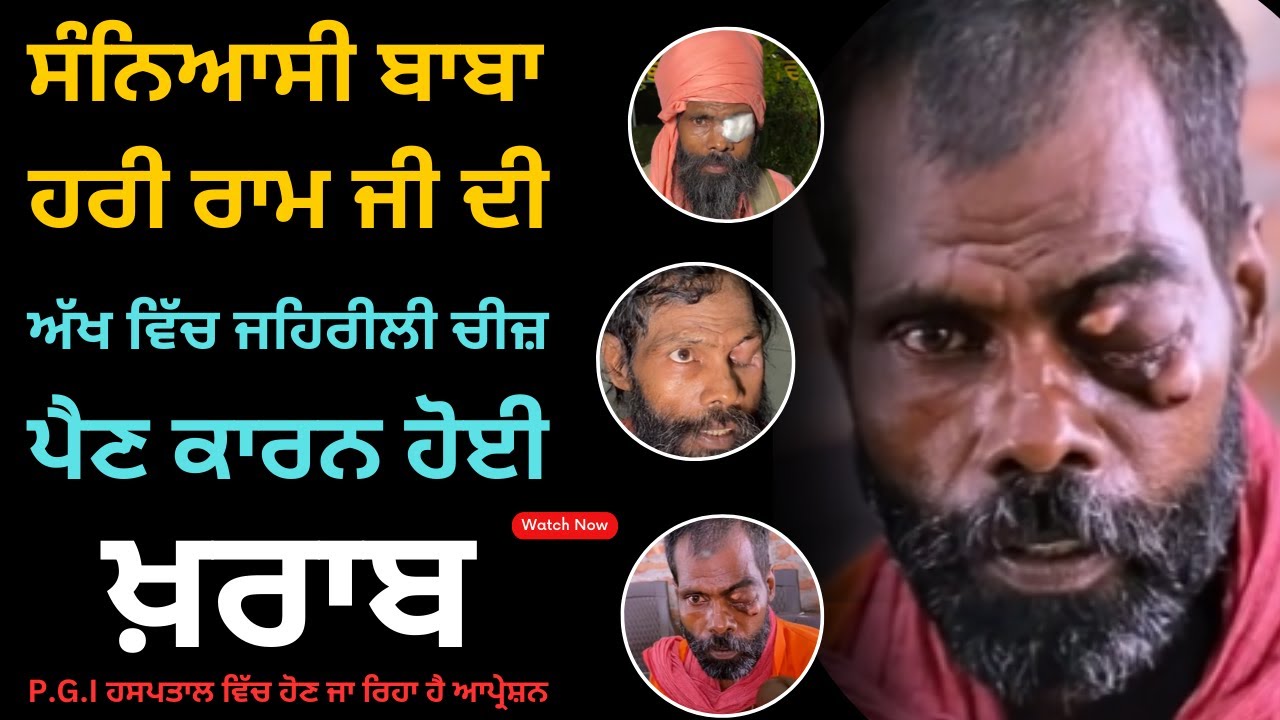 ⁣ਸੰਨਿਆਸੀ ਬਾਬਾ ਹਰੀ ਰਾਮ ਜੀ ਦੀ ਅੱਖ ਵਿੱਚ ਜਹਿਰੀਲੀ ਚੀਜ਼ ਪੈਣ ਕਾਰਨ ਹੋਈ  ਖ਼ਰਾਬ  | Manukhta Di Sewa Society |