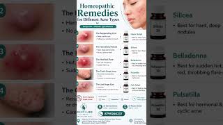 Homeopathic Remedies for Different Acne Types | Acne Guide #viral #skincare #acne #pimple #antiacne