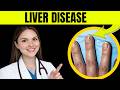 12 Visible Signs Your Liver Is In Danger ⚠️ (Doctor Explains)