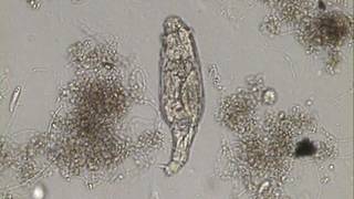 Rotifer