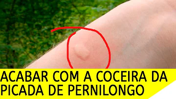 O que é bom para alergia à picada de mosquito?