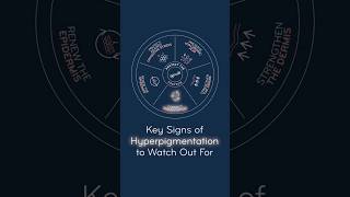 How To Recognize Early Signs Of Hyperpigmentation  Naos