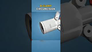 Prostate Enlargement Surgery Explained | 3D Animation #ProstateHealth #MensHealth
