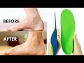 The TRUTH about Arch Support