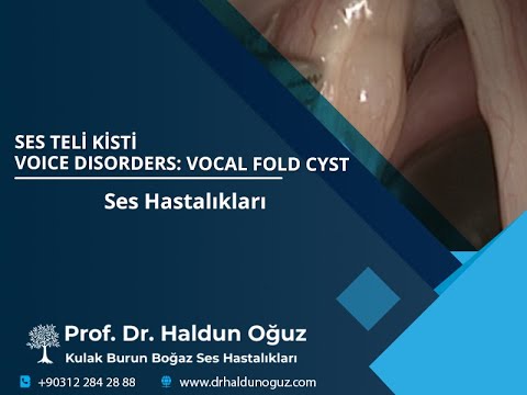 Ses Hastalıkları: Ses Teli Kisti - Voice Disorders: Vocal Fold Cyst