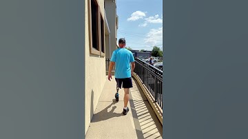 Above Knee Amputee with Osseointegration Prosthetic Training