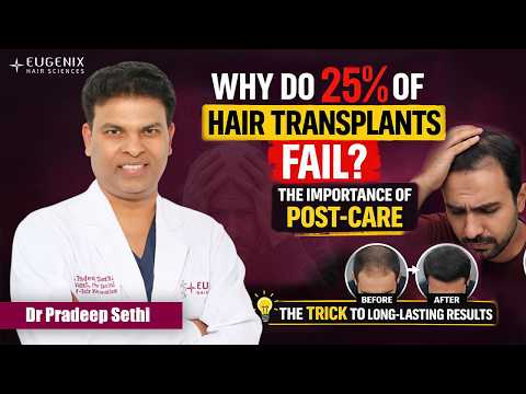 Why Do 25% of Hair Transplants Fail? The Importance of Post-Care