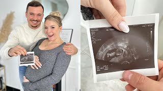 Thumbnail for Ultraschall SSW 12 🤰 Wie geht's unserem Baby? 👶🏼