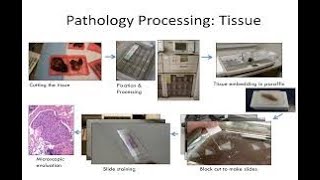 revision of tissue processing and staining