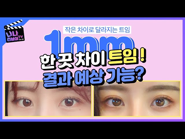 [앞트임/뒤트임] 눈성형의 완성은 트임!👀 성공 확률 자가진단 해볼 수 있을까요?