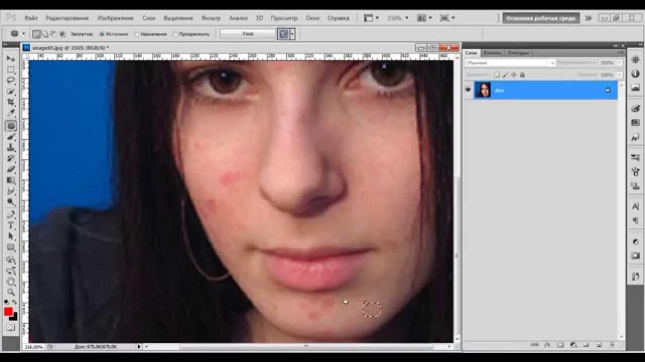приложение где убрать прыщи