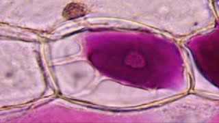 Quelle est la différence entre la plasmolyse et la turgescence