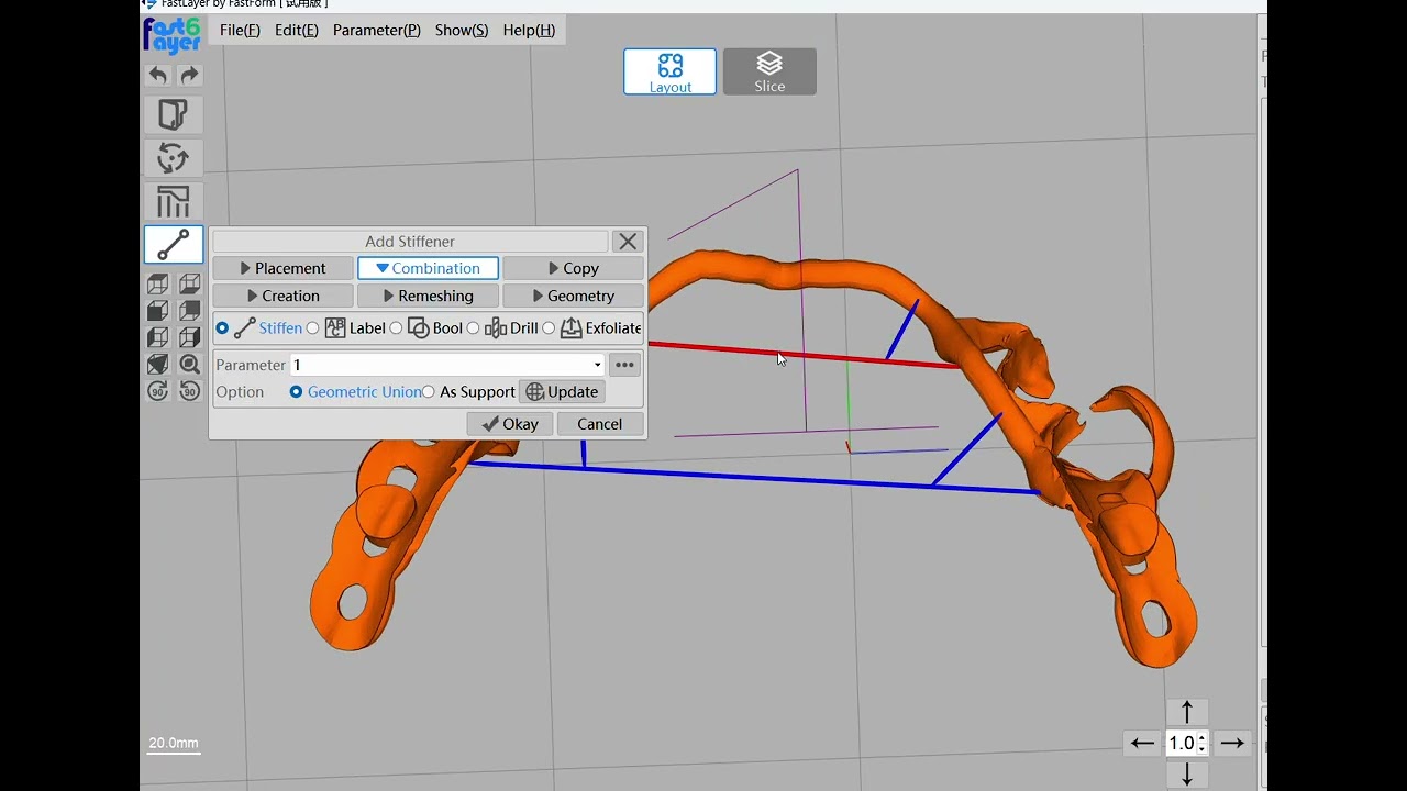 How to set up the supports for RPD by fastform Fastlayer nesting software