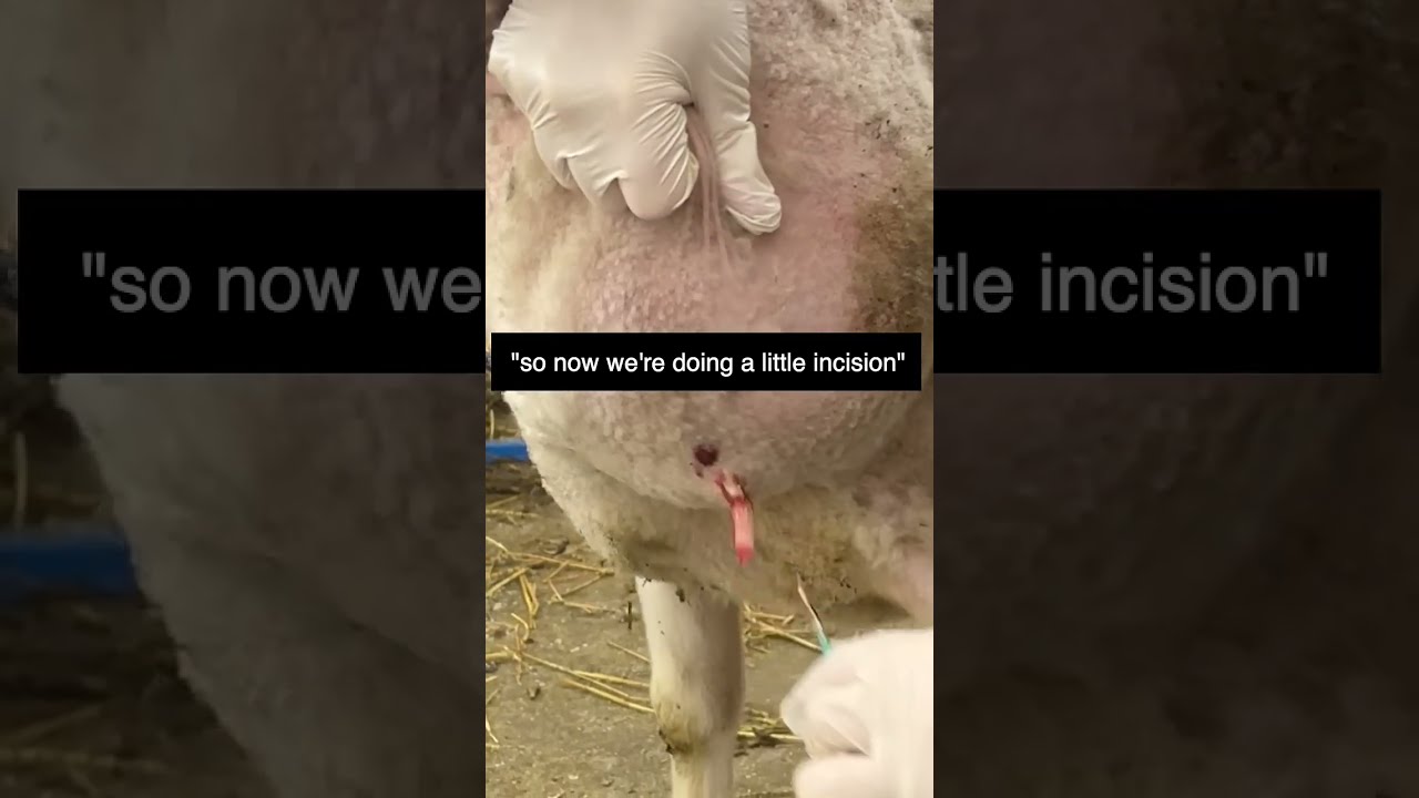  Shorts CALLING DR PIMPLE POPPER