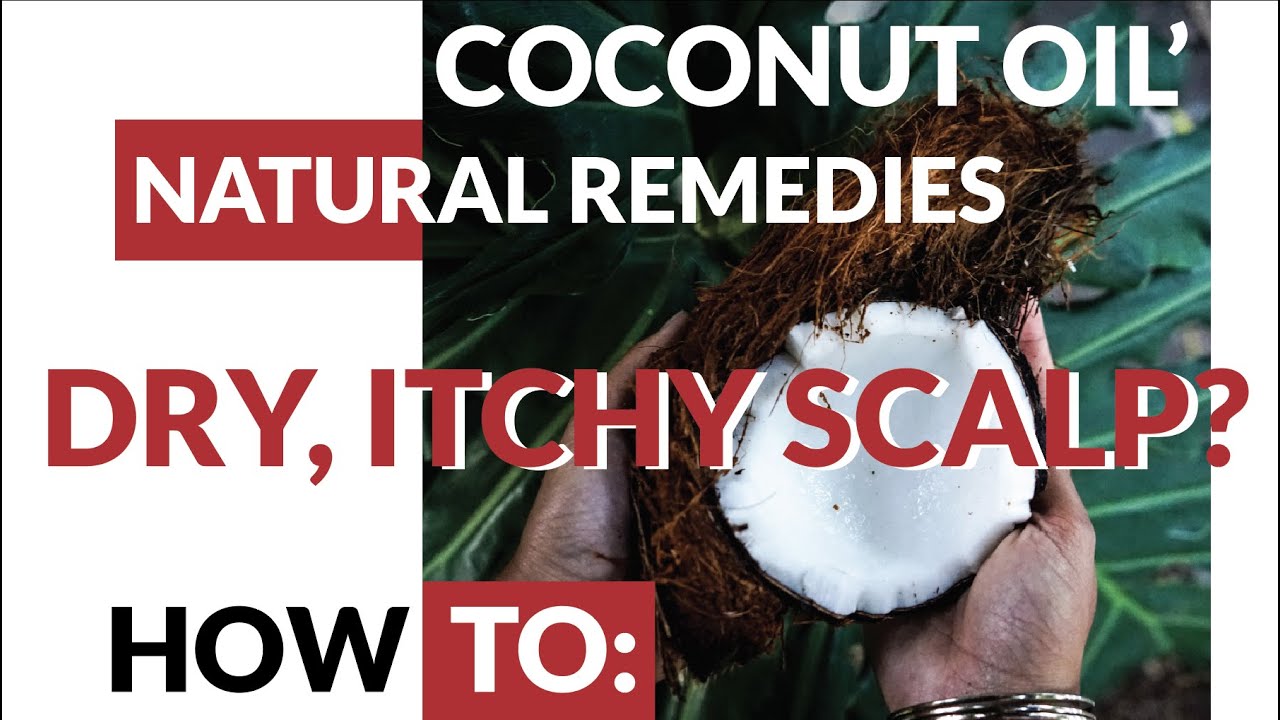 How To Cure Dry Scalp Natural Remedies, Coconut Oil Afrotex