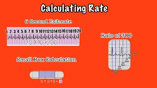 EKG Rate: Step 2 of The 8 Step Method (EKG Rhythm Interpretation Part 6.2)