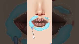 Extreme Lip Cleaning ASMR 👄 | Satisfying Blackhead &amp; Hair Removal #Shorts #relaxingsounds #asmr