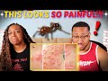 Brave Wilderness "Stung by 500 Fire Ants!" REACTION!!!