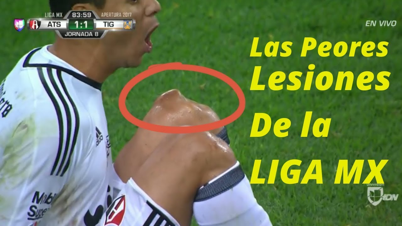Top 5 De las peores Lesiones de la LIGA MX - YouTube
