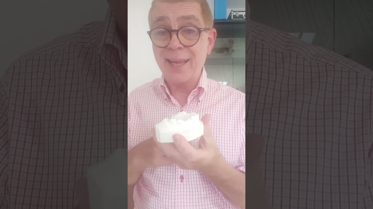 La protesi fissa con il ponte dentale Dentista a San Benedetto del Tronto,provincia di Ascoli Piceno