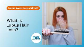 Is Lupus Causing Your Hair Loss?  Medi Hair Loss & Scalp Clinic Toronto & Ottawa