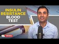 Homair the crucial insulin resistance blood test doctors dont use