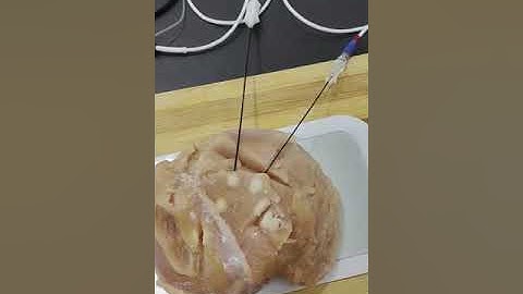 surgilab unified rf cannula test with cosman G4 generator