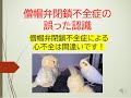 僧帽弁閉鎖不全症の誤った認識(「MRによる心不全」が間違いな理由を循環器医が説明します)