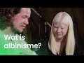 Wat is albinisme?