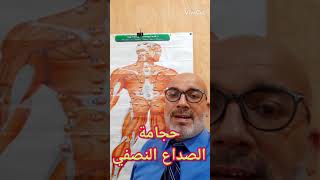 حجامة الصداع النصفي(الشقيقة )